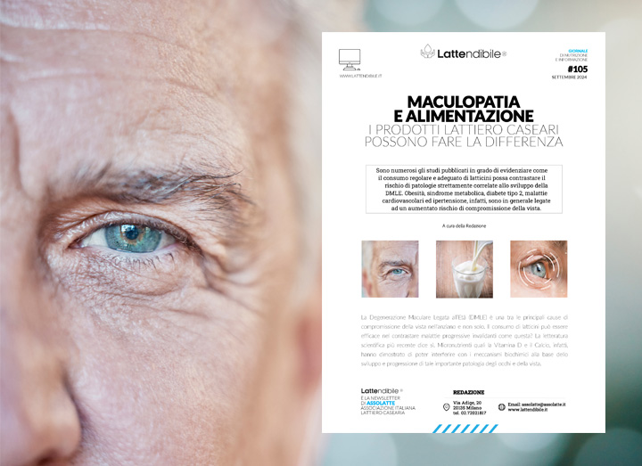 LATTE E DERIVATI NELLA PREVENZIONE DELLA MACULOPATIA. IL NUOVO NUMERO DE LATTENDIBILE